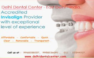 Dental Braces Delhi India