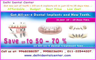 Cheap and Best Dental Implant in Delhi India
