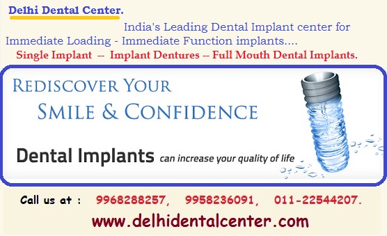 Who is All-on-4 Dentist in India