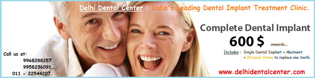 Best all-on-4 Clinic in India