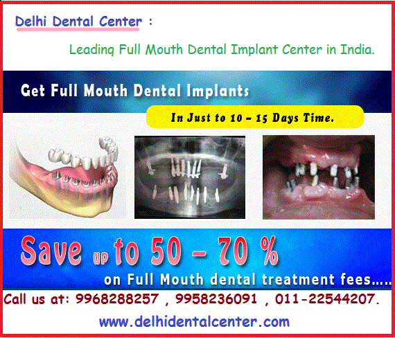 Get Cost of Full Mouth treatment in India