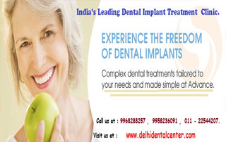 Best price All-on-4 dental implant in India