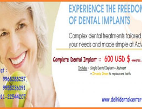 Cheapest all-on-4 dental implant in India