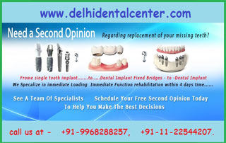 What is the Cost of Full Mouth dental implant in India
