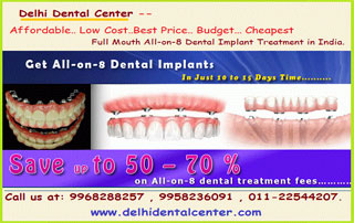 Average Cost of all on four dental implant in India