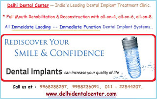 Low cost all-on-6 dental treatment in India