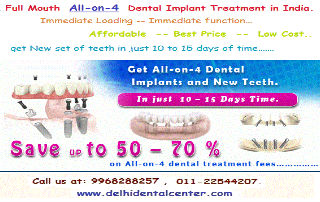 Full Mouth Dental Implant Delhi India