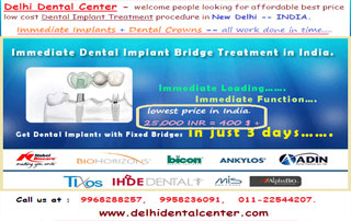 full mouth dental implant dentist and clinic in India (2)