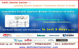 full mouth dental implant dentist and clinic in India (3)