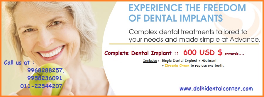 All-On-8 Dental Implant Treatment In India