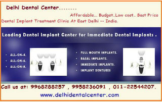 full mouth dental implant delhi india (1)