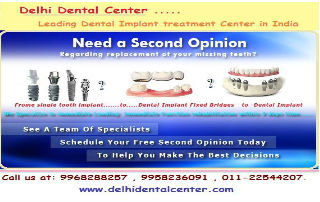 full mouth dental implant delhi india (6)