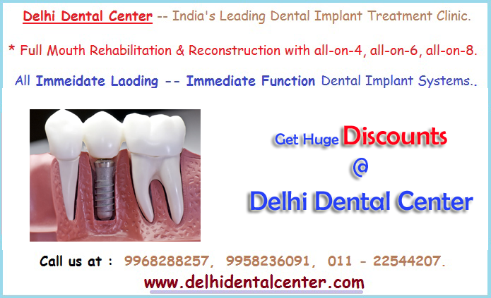 Dental_Implant_Treatment_De