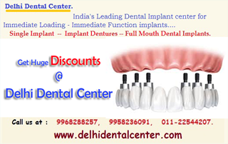 Dental Implant Delhi India