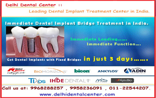 All_on_4_Dental_Implants