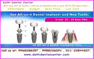All_on_4_Dental_Implants
