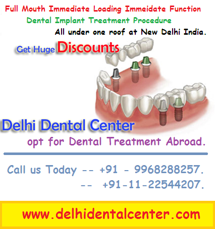 low_cost_price_dental_impla