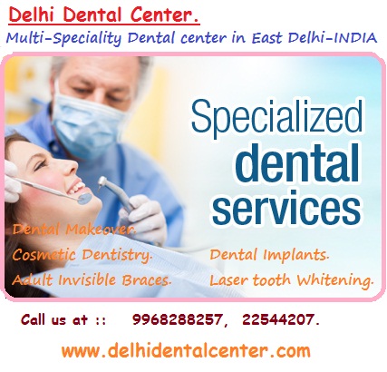 Best Dental Veneer and Componeer Dentist in Delhi India