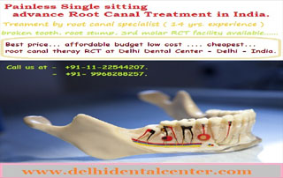 Root Canal Treatment (RCT) in East Delhi, India