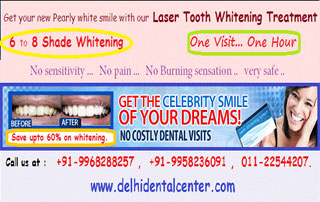 Dental whitening in East Delhi