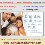 Tooth Whitening Clinic in India