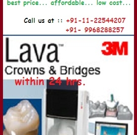 3M-LAVA-dental-crown-Delhi-India.