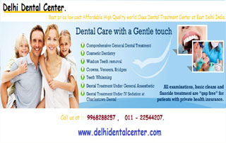 Instant Dental Veneer Treatment in Delhi, India