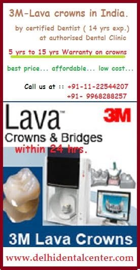 3M-LAVA-dental-crown-Delhi-India.