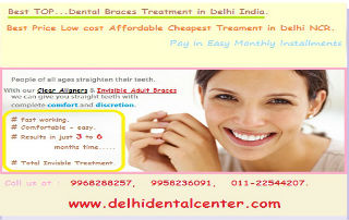 Dental braces delhi