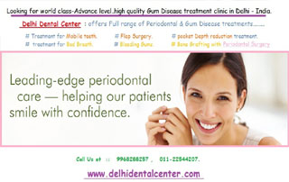 Gum Disease Treatment in Delhi