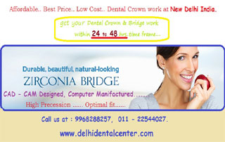 Dental Crown Dentist in Delhi