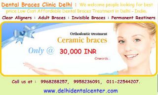 Dental braces Clinic in East Delhi