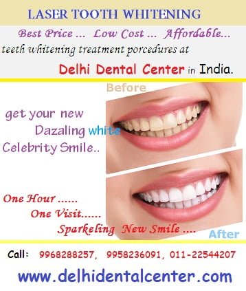 tooth whitening