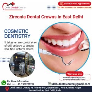 Zirconia Dental Crowns in East Delhi