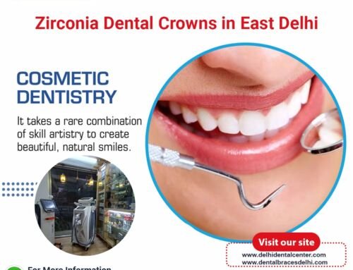 Zirconia Dental Crowns in East Delhi