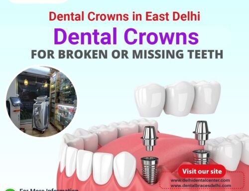 Dental Crowns in East Delhi