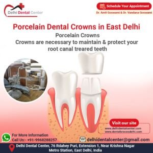 Porcelain Dental Crowns in East Delhi