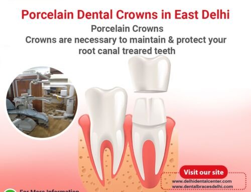 Porcelain Dental Crowns in East Delhi