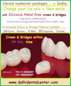 Porcelain Zirconia Ceramic CAD CAM Metal Free Dental Tooth Crowns, Dental Tooth Cap Treatment at Dental Crown Dentist Dental Clinic in Vaishali, Noida, Ghaziabad