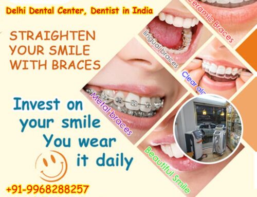 Delhi Dental Center, Dentist in India