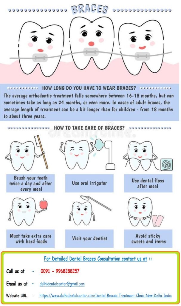 Top Best Invisible Tooth Colored Ceramic Dental Braces Aligners, Retainers Specialist Braces Dentist Orthodontist Dental Clinic in East Delhi.