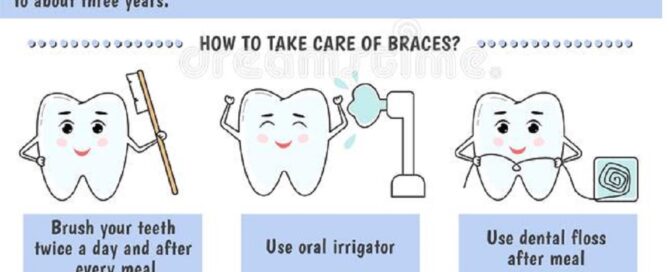 Where to get Best Dental Braces Treatment Procedure in Mohan Nagar Ghaziabad Noida