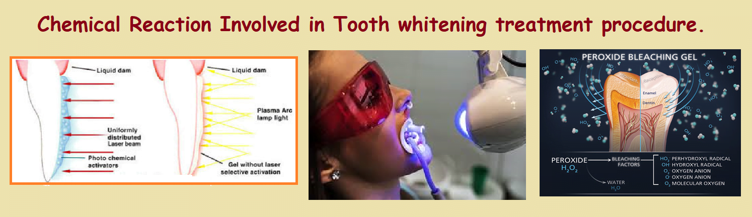 Tooth Whitening Dentist in Delhi