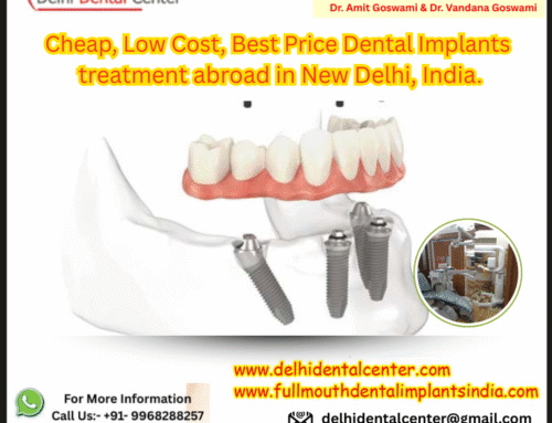 Cheap, Low Cost, Best Price Dental Implants treatment abroad in New Delhi, India.