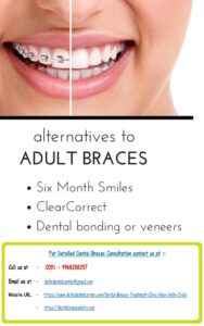 Dental Teeth Braces Specialist Dentist Orthodontist in Arjun Nagar East Delhi
