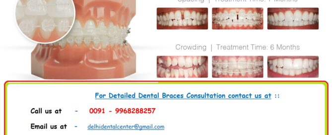 Orthodontist in Krishna Nagar.