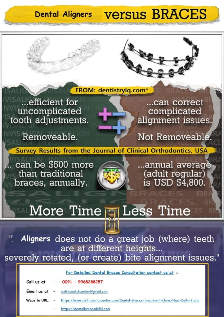 Dental Braces Dentist in Vishwas Nagar.