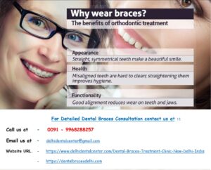 Dental Braces Treatment in East Delhi.