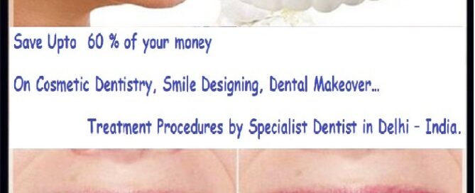 Laser Tooth Whitening Clinic in Delhi