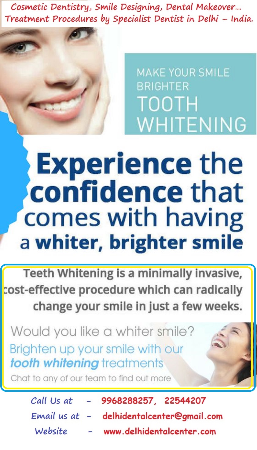 Tooth Whitening Dental Clinic in East Delhi